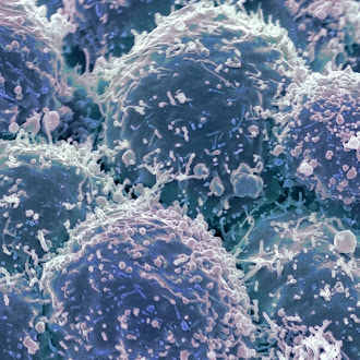 EGFR y nuevas terapias transforman tratamiento pulmonar